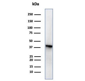 Western blot testing of human PC3 cell lysate using MASPIN antibody (clone SERPINB5/4977). Predicted