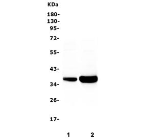 TNNT3 Antibody