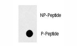 FAS Antibody (phospho-Y291)