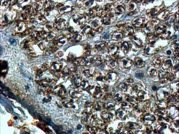 SLIT2 Antibody