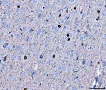 TWIST1/2 Antibody