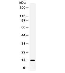 Western blot testing of mouse ovary lysate with S100A9 antibody. Expected/observed molecular weight 