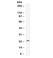 Western blot testing of human MCF7 cell lysate with CNTF antibody. Expected/observed molecular weigh