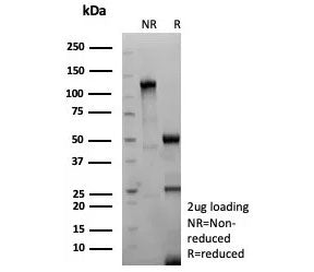 Thyroid Stimulating Hormone Receptor / TSHR Antibody (beta chain)