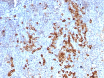 Kappa Light Chain Antibody