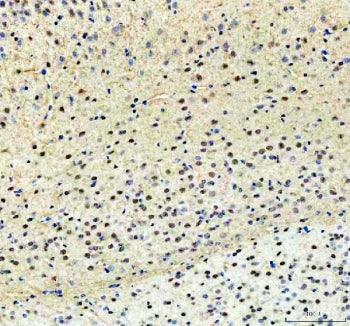 IHC staining of FFPE mouse brain tissue with PKC beta antibody. HIER: boil tissue sections in pH8 ED