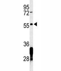 Western blot analysis of RNF8 antibody and Jurkat lysate. Predicted molecular weight ~56 kDa but may