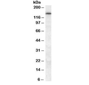 Western blot testing of human frontal cortex lysate with ABCC5 antibody at 0.5ug/ml. Predicted molec