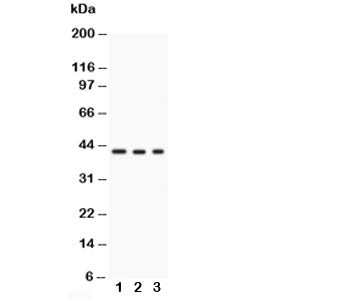 Western blot testing of GAP43 antibody and Lane 1: U87; 2: rat brain; 3: mouse brain; Predicted/obse