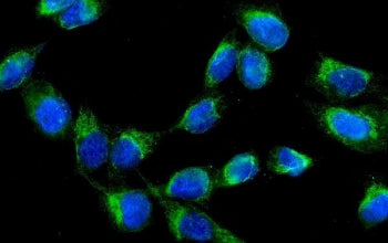 Immunofluorescent staining of FFPE human U-2 OS cells with AK2 antibody (green) and DAPI nuclear sta