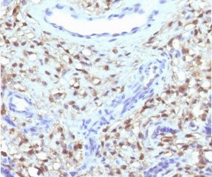 S100A4 Antibody / FSP1