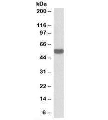 Western blot testing of HeLa lysate with HSPC117 antibody at 0.3ug/ml. Predicted/observed molecular 