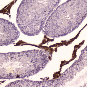 IHC testing of FFPE mouse testis tissue with Cyp17a1 antibody at 2ug/ml. HIER: boil tissue sections 