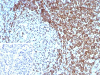 IHC staining of FFPE human tonsil tissue with CD3 delta antibody (clone CD3D/8898). Inset: PBS used 