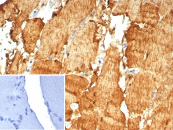 IHC staining of FFPE human skeletal muscle tissue with Carbonic Anhydrase 3 antibody (clone CA3/7883