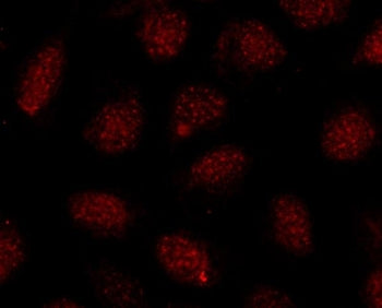 SOX10 Antibody
