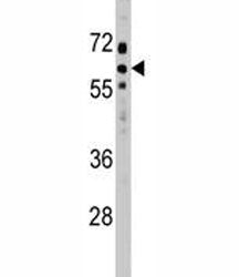 SOCS7 Antibody