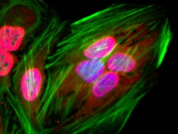 Acetyl Lysine Antibody