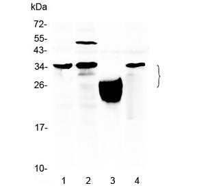 TFPI2 Antibody