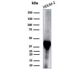 Western blot testing of human HDLM-2 cell lysate with STING1 antibody (clone STING1/7439). Predicted
