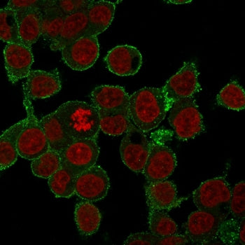 TNF alpha Antibody