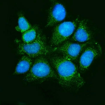 Immunofluorescent staining of FFPE human MCF7 cells with ASK1 antibody (green) and DAPI nuclear stai