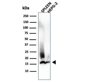 Lysozyme C Antibody / LYZ