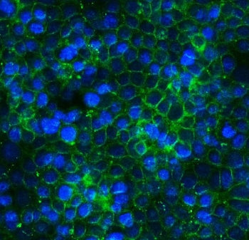 Claudin 3 Antibody / CLDN3