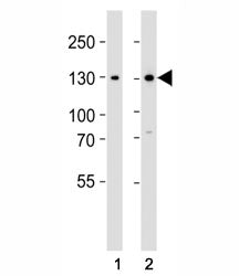 Western blot analysis of lysate from (1) 293 and (2) Jurkat cell line using GLI2 antibody at 1:1000.