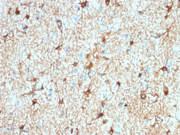 GFAP Antibody / Glial Fibrillary Acidic Protein