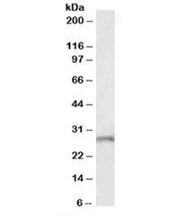Western blot testing of mouse brain lysate with Fgf14 antibody at 1ug/ml. Predicted molecular weight
