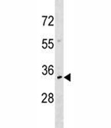 NKX2.6 Antibody