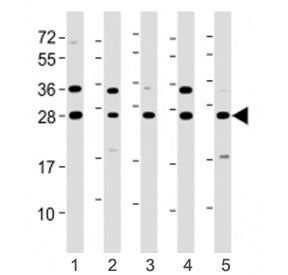 ERAB Antibody / HSD17B10 (N-Terminal Region)