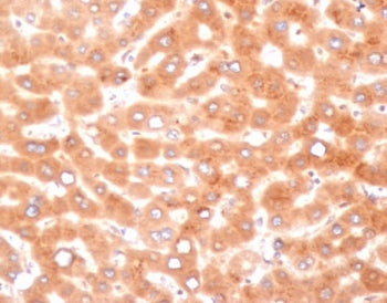 IHC staining of FFPE human liver tissue with Alpha-1-Antichymotrypsin antibody (clone SERPINA3/4187)