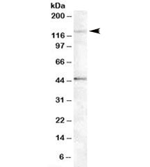 Tankyrase 2 Antibody