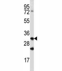 Cathepsin Q Antibody