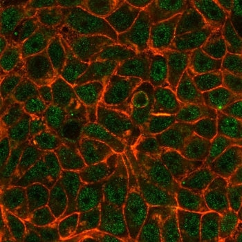 TIF1 alpha Antibody / TIF1A / TRIM24