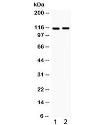 Western blot testing of 1) rat brain and 2) mouse brain with Eph Receptor A5 antibody. Expected/obse