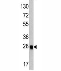 ATG12 Antibody