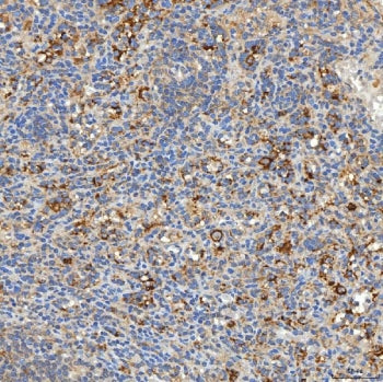 IHC staining of FFPE human spleen tissue with Syntaphilin antibody. HIER: boil tissue sections in pH