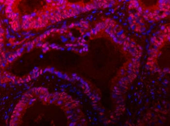 TIGD1 Antibody / Tigger transposable element-derived protein 1