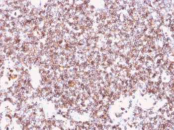 IHC staining of FFPE human tonsil with recombinant CD45 antibody (clone rPTPRC/1461). HIER: boil tis