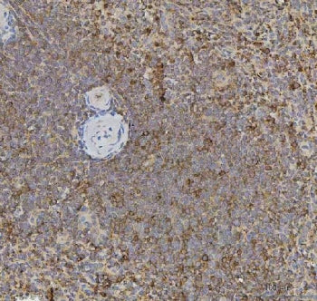 XCR1 Antibody / Chemokine XC receptor 1 / CCXCR1