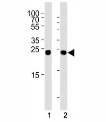 Glucagon Antibody