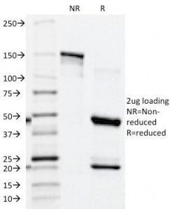 SDS-PAGE Analysis of Purified, BSA-Free PSAP Antibody (ACPP/1339). Confirmation of Integrity and Pur