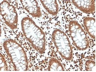 IHC staining of FFPE human colon tissue with p27Kip1 antibody (clone KIP1/1357) at 2ug/ml in PBS for