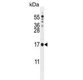 IQCJ Antibody