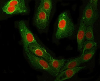 Immunofluorescent staining of FFPE human U-2 OS cells with RFC4 antibody (red) and Beta Tubulin mAb 