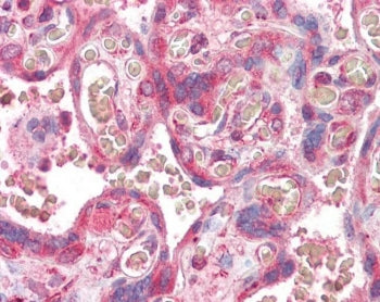 ERV3 Antibody / ERV3-1