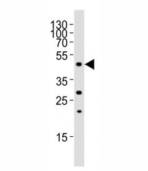 Western blot analysis of lysate from rat liver tissue, using FOXA2 antibody at 1:1000. Predicted mol